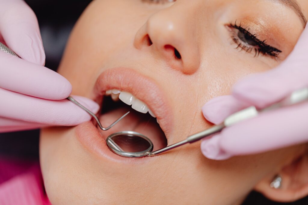 Tips on How to Find the Best Dental Implant Dentist in London